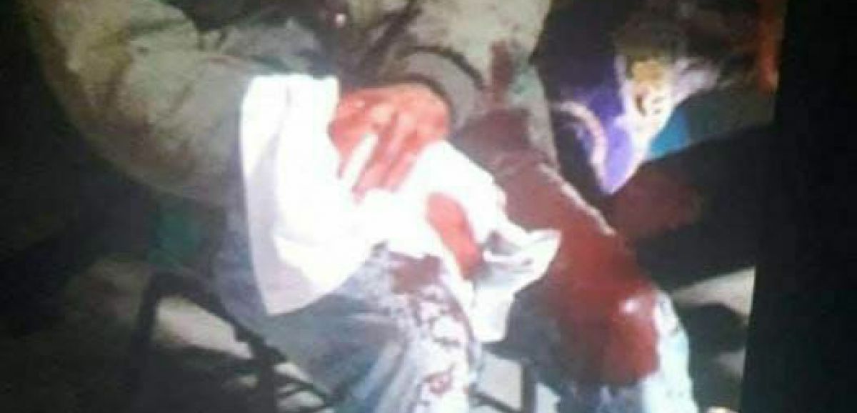 Un terroriste blessé à Hébron alors qu'il tentait de faire exploser une bombe